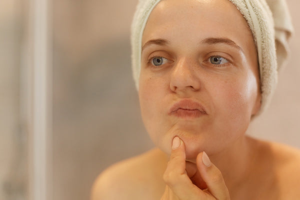 Oily Skin? Here's How to Deal With It