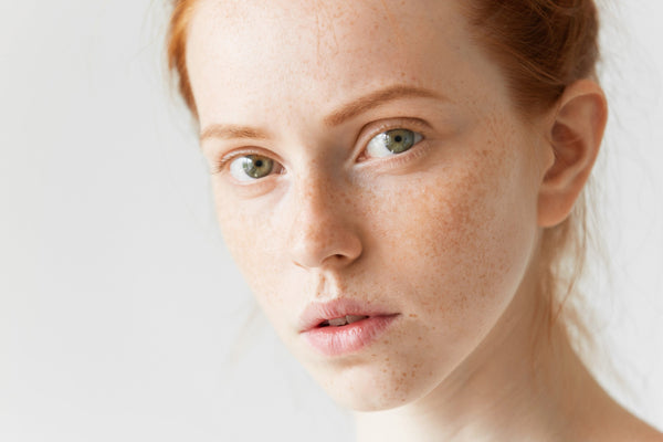 How to Keep Pigmentation at Bay This Summer