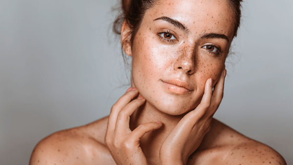 How to Treat Hyperpigmentation With the Right Ingredients